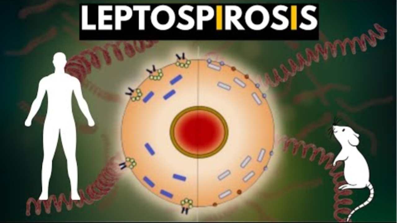 Monsoon Fever Alert- Leptospirosis 